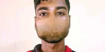 पर्सामा श्रीमतीको घाँटी थिची हत्या गर्ने श्रीमान पक्राउ, पारिवारिक विवाद रहेको खुलासा