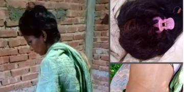 बारामा महिलामाथि बोक्सीको आरोपमा कुटपिट र कपाल काट्ने अमानवीय व्यवहार